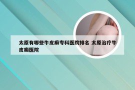 太原有哪些牛皮癣专科医院排名 太原治疗牛皮癜医院