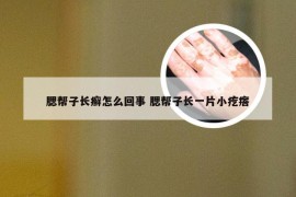 腮帮子长癣怎么回事 腮帮子长一片小疙瘩