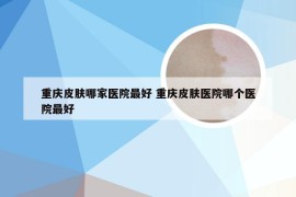 重庆皮肤哪家医院最好 重庆皮肤医院哪个医院最好
