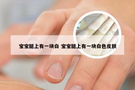 宝宝腿上有一块白 宝宝腿上有一块白色皮肤