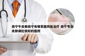 南宁牛皮癣南宁有哪家医院能治疗 南宁专治皮肤病比较好的医院