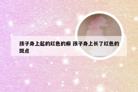 孩子身上起的红色的癣 孩子身上长了红色的斑点