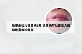 地塞米松片银屑病2天 银屑病可以用复方醋酸地塞米松乳膏