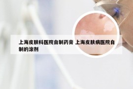 上海皮肤科医院自制药膏 上海皮肤病医院自制的涂剂