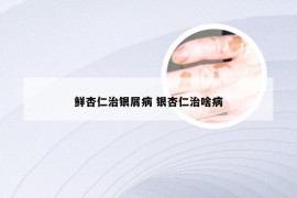 鲜杏仁治银屑病 银杏仁治啥病