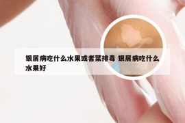 银屑病吃什么水果或者菜排毒 银屑病吃什么水果好