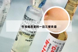 牛皮癣患者的一日三餐食谱