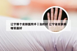 辽宁那个皮肤医院手廯治的好 辽宁省皮肤病哪家最好