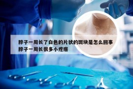 脖子一周长了白色的片状的斑块是怎么回事 脖子一周长很多小疙瘩