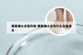 银屑病小点变片啦 银屑病小点为什么会连成片