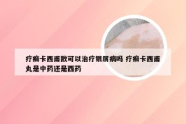 疗癣卡西甫散可以治疗银屑病吗 疗癣卡西甫丸是中药还是西药