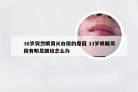 38岁突然眼周长白斑的原因 33岁眼睛周围有明显皱纹怎么办