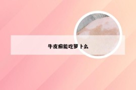 牛皮癣能吃萝卜么