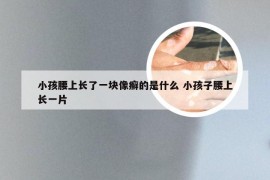 小孩腰上长了一块像癣的是什么 小孩子腰上长一片
