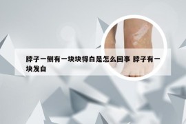 脖子一侧有一块块得白是怎么回事 脖子有一块发白