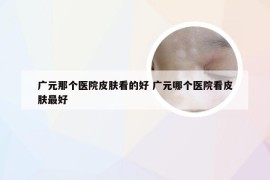 广元那个医院皮肤看的好 广元哪个医院看皮肤最好