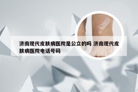 济南现代皮肤病医院是公立的吗 济南现代皮肤病医院电话号码