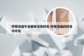 柠檬泡澡牛皮癣有没有好处 柠檬泡澡的好处与坏处
