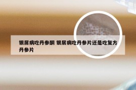 银屑病吃丹参酮 银屑病吃丹参片还是吃复方丹参片