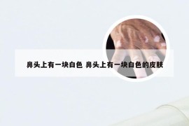 鼻头上有一块白色 鼻头上有一块白色的皮肤