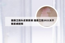 健康之路头皮银屑病 健康之路2021关于银屑病视频