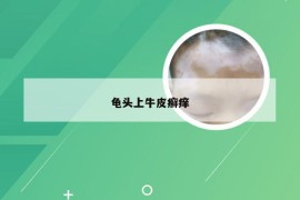 龟头上牛皮癣痒