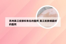 苏州吴江皮肤科有名的医院 吴江皮肤病最好的医院