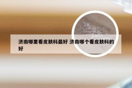 济南哪里看皮肤科最好 济南哪个看皮肤科的好