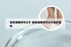 银屑病踢球可以不 银屑病踢球可以不戴护膝吗