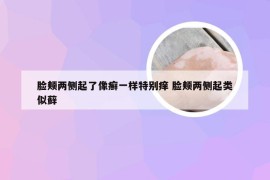 脸颊两侧起了像癣一样特别痒 脸颊两侧起类似藓