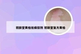 初肤堂黄柏祛癣搽剂 初肤堂复方黄柏
