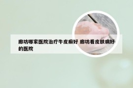 廊坊哪家医院治疗牛皮癣好 廊坊看皮肤病好的医院