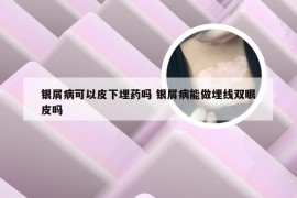 银屑病可以皮下埋药吗 银屑病能做埋线双眼皮吗