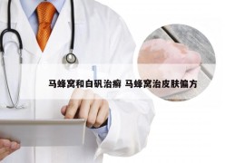 马蜂窝和白矾治癣 马蜂窝治皮肤偏方