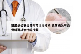银屑病关节炎骨科可以治疗吗 银屑病关节炎骨科可以治疗吗视频