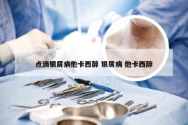 点滴银屑病他卡西醇 银屑病 他卡西醇