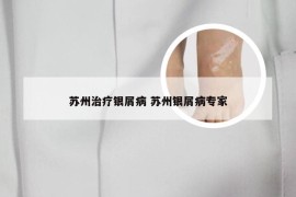 苏州治疗银屑病 苏州银屑病专家