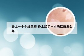 身上一个个红色癣 身上起了一小块红癣怎么办