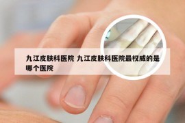 九江皮肤科医院 九江皮肤科医院最权威的是哪个医院