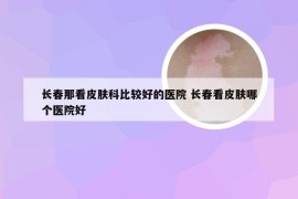 长春那看皮肤科比较好的医院 长春看皮肤哪个医院好