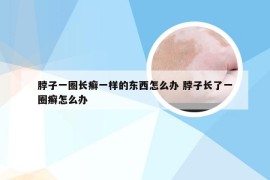 脖子一圈长癣一样的东西怎么办 脖子长了一圈癣怎么办