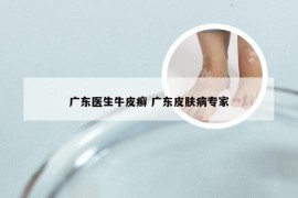 广东医生牛皮癣 广东皮肤病专家