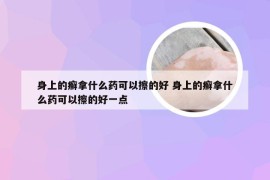 身上的癣拿什么药可以擦的好 身上的癣拿什么药可以擦的好一点