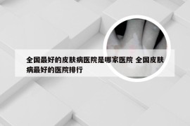 全国最好的皮肤病医院是哪家医院 全国皮肤病最好的医院排行
