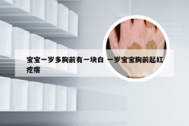 宝宝一岁多胸前有一块白 一岁宝宝胸前起红疙瘩