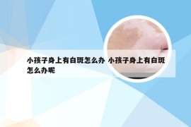 小孩子身上有白斑怎么办 小孩子身上有白斑怎么办呢