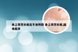 身上突然长癣且不来例假 身上突然长癣,越来越多