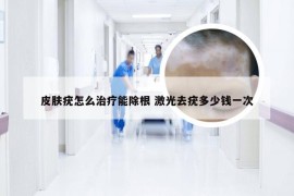 皮肤疣怎么治疗能除根 激光去疣多少钱一次
