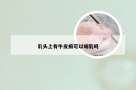 乳头上有牛皮癣可以哺乳吗