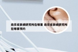 南京皮肤病研究所在哪里 南京皮肤病研究所在哪里预约